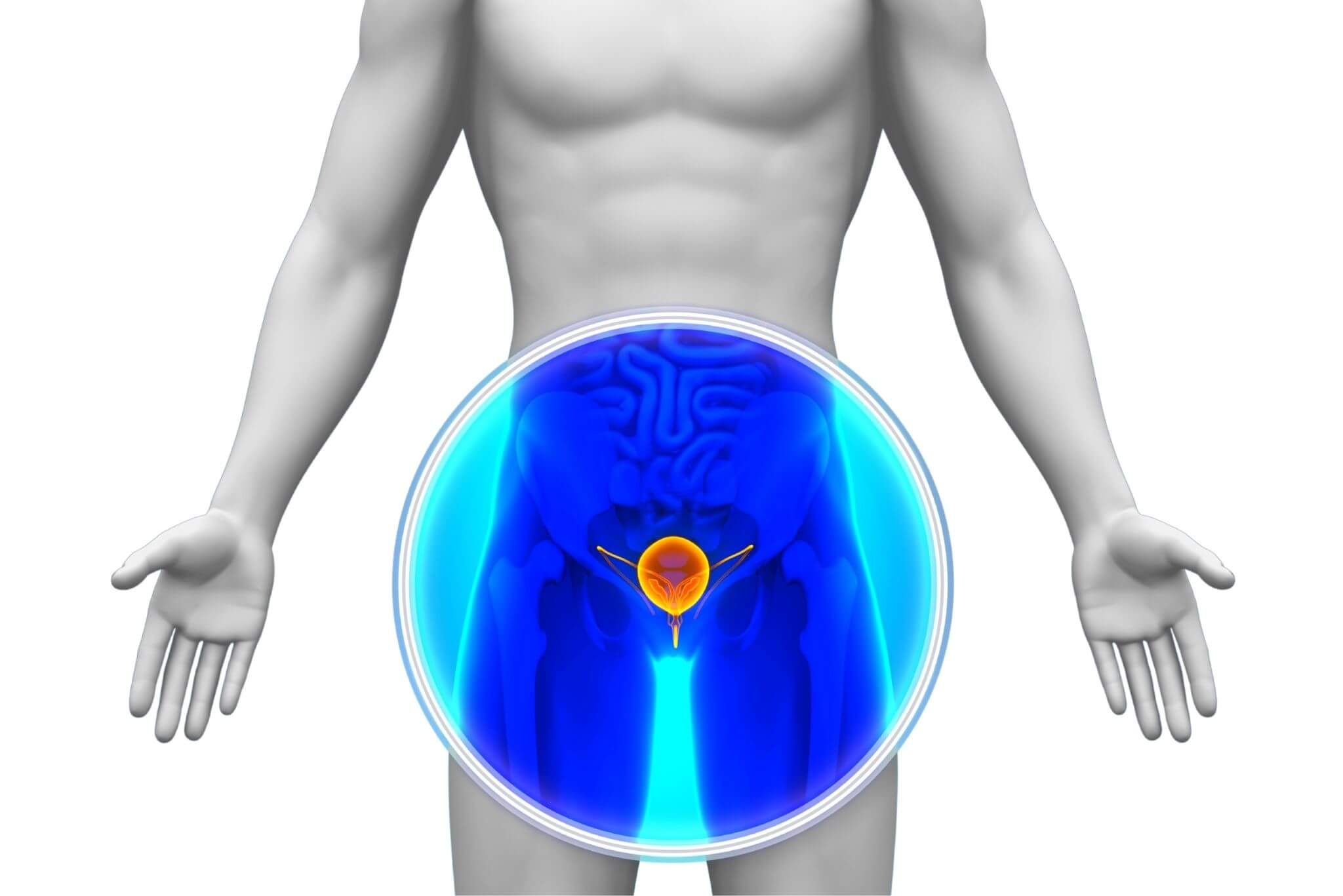 Prostatitis kezelése SFM 01 Elat, Eszköz ulp mavit prosztata adenoma kezelése