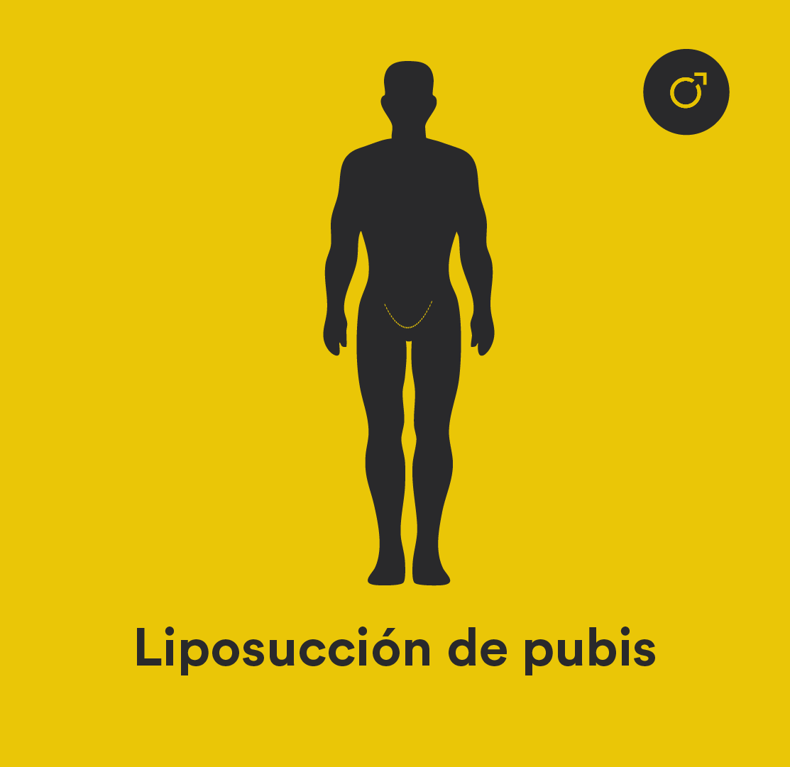 liposucción de pubis